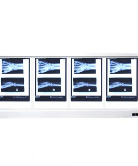 Négatoscope Ultra-Fin LED - Matériel Consommable MonPara Maroc