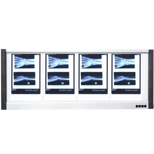 Négatoscope Ultra-Fin LED - Matériel Consommable MonPara Maroc